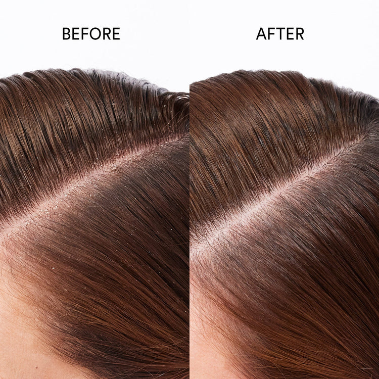 Pure Genius Scalp Restoring Oil